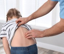 Mochila pesada pode comprometer a saúde de crianças e adolescentes, alerta ortopedista