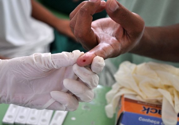 Alagoas deve realizar exames em paciente com hepatite B