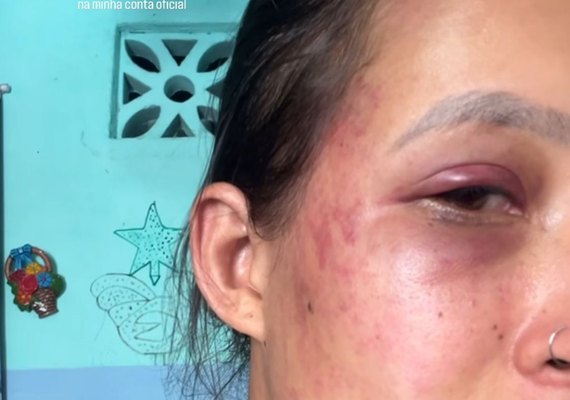 Mulher denuncia companheiro por violência doméstica após recusar ter relação sexual
