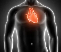 Estudo detecta microplásticos no sangue de vítimas de infarto