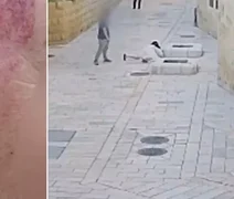 Homem é preso após agredir freira católica de 48 anos em Jerusalém