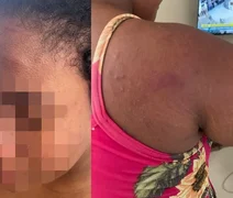 Caso de tortura contra doméstica grávida choca o Maranhão