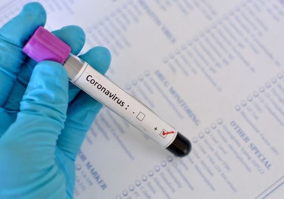Brasil tem mais de 1 milhão de casos confirmados de Covid-19