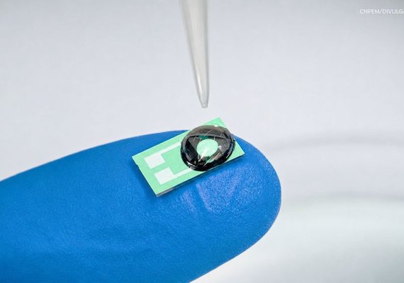 Sensor que detecta metástase é uma das inovações radicais em desenvolvimento no SUS