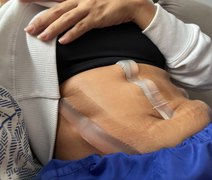 Mulheres que denunciaram cirurgião plástico terão casos analisados por perito