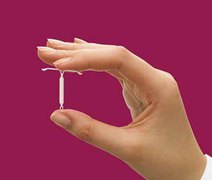 DIU: saiba mais informações sobre o método contraceptivo