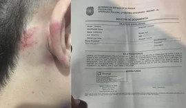 Casal de amigos é roubado e agredido durante arrastão na praia Ponta Verde