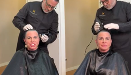 Gretchen raspa cabelo ao vivo antes de transplante capilar contra alopecia
